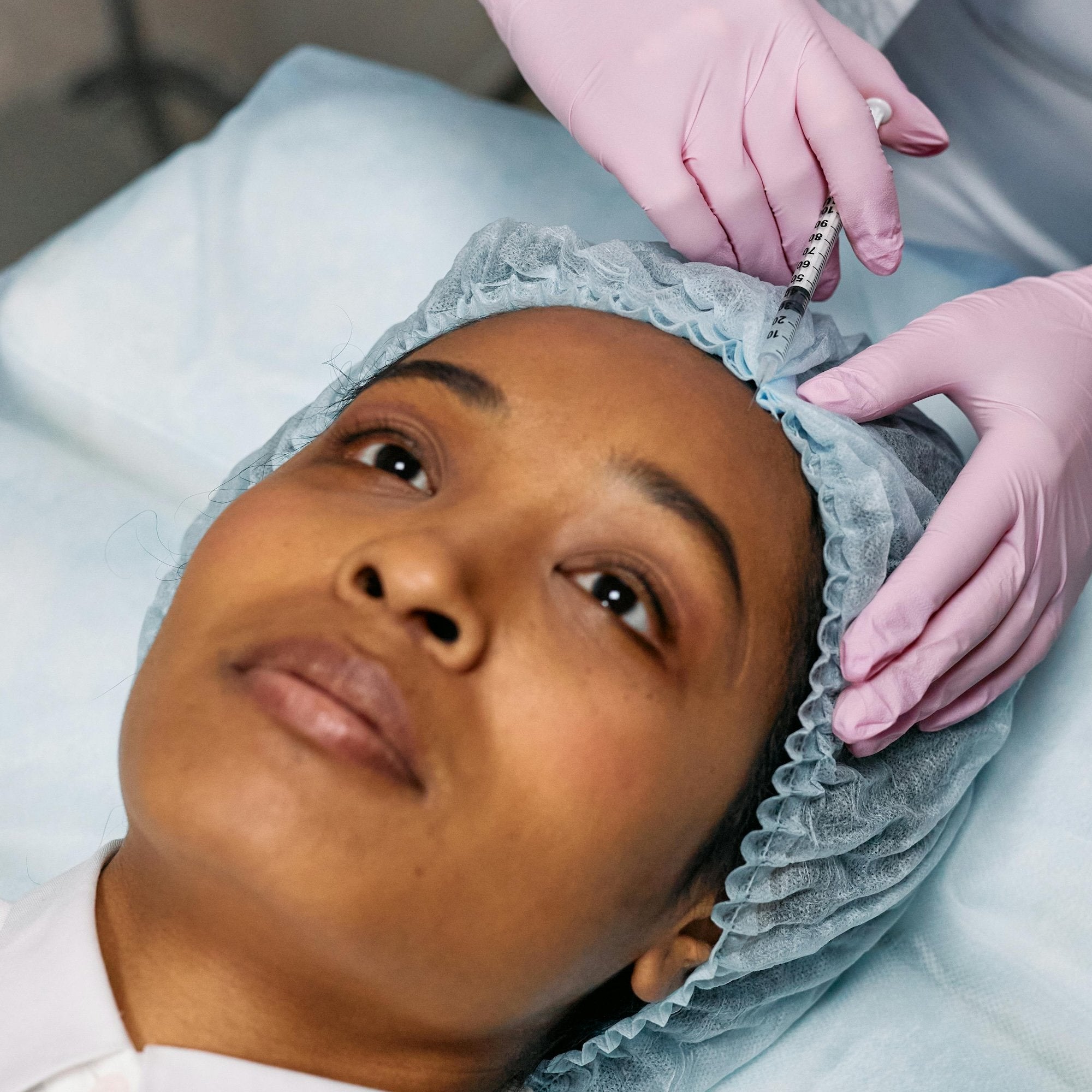Plateful of Potential: Unravelling the Secrets of Platelet Rich Plasma Therapy for Hair Loss