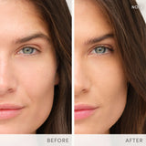Enlighten Plus™ Under-eye Concealer